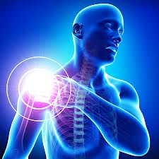 Cahir Physiotherapist frozen shoulder